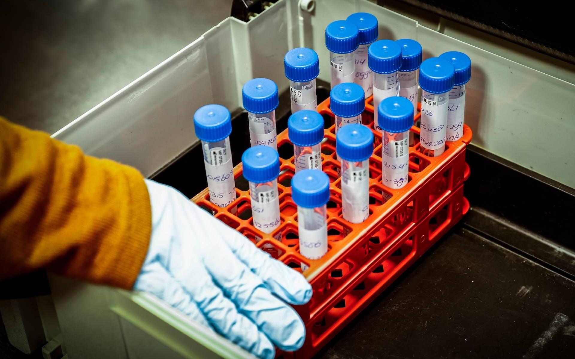 Twee roeiers uit 'gouden' EK-ploeg besmet met coronavirus