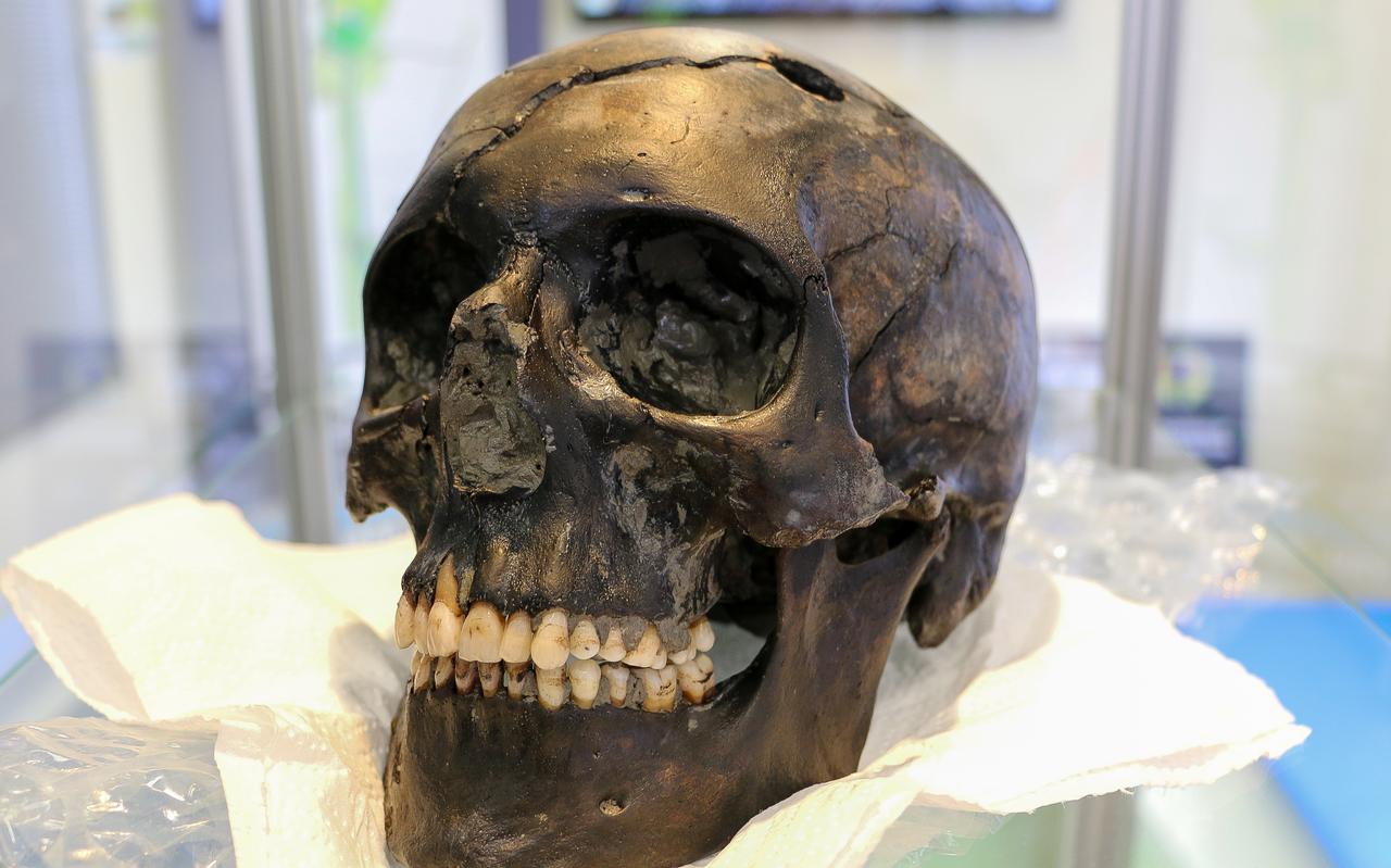 De schedel met kogelgat was woensdag voor geïnteresseerden te bezichtigen. Door de lokale bodemsamenstelling is het bot zwart verkleurd. FOTO LC/ARODI BUITENWERF De schedel met kogelgat was woensdag voor geïnteresseerden te bezichtigen. Door de lokale bodemsamenstelling is het bot zwart verkleurd. FOTO LC/ARODI BUITENWERF