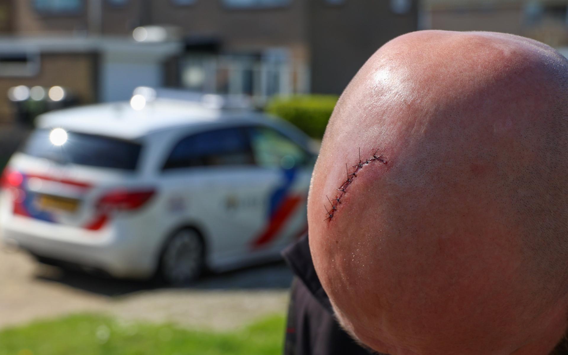 Man mishandeld na betrappen inbrekers in Stiens, politie zoekt verdachten.