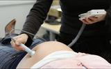 Een verloskundige luistert naar het hartje van een ongeboren baby. Verloskundigen zien een toename van vrouwen die tijdens de lockdown zwanger zijn geraakt.